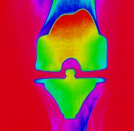 knee small