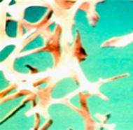 osteoporosis_image