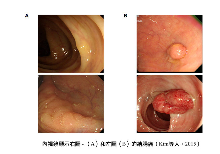 proximal and distal colon images