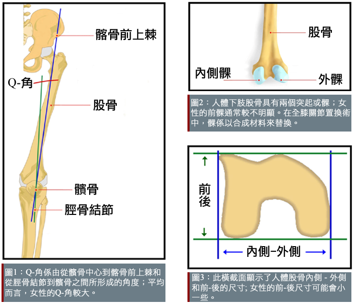 knee differences in women and men